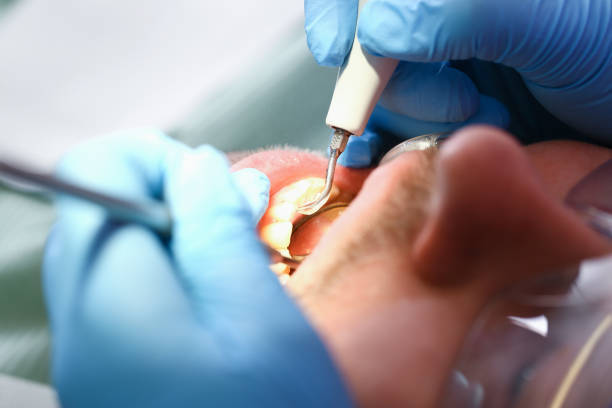 Best Emergency Dental Care for Broken or Chipped Teeth in Abaster, AL