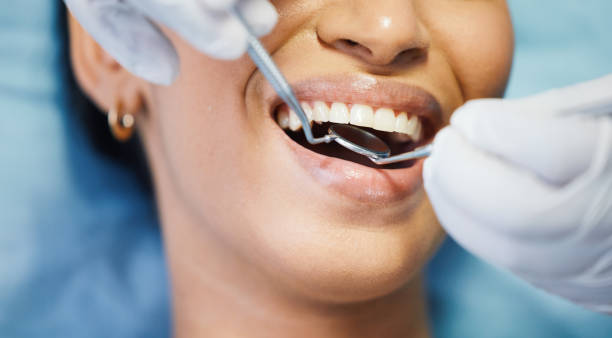 Best Emergency Treatment for Dental Infections or Abscesses in Abaster, AL